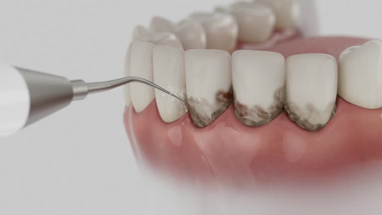 Trusted Dental Implants service in Braddock Hills, PA - Dentist Open Now